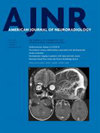 American Journal Of Neuroradiology期刊封面
